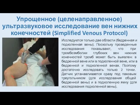 Упрощенное (целенаправленное) ультразвуковое исследование вен нижних конечностей (Simplified Venous Protocol) Исследуются