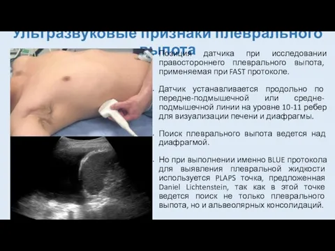 Ультразвуковые признаки плеврального выпота Позиция датчика при исследовании правостороннего плеврального выпота,