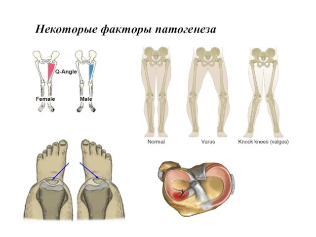 Некоторые факторы патогенеза