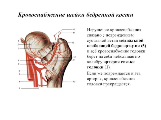 Кровоснабжение шейки бедренной кости Нарушение кровоснабжения связано с повреждением суставной ветви