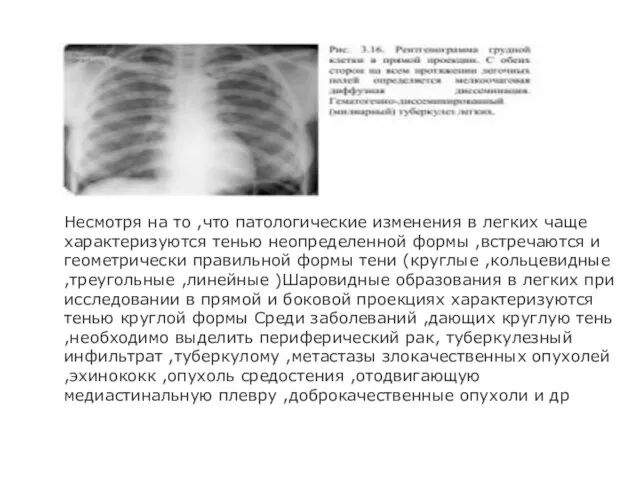 Несмотря на то ,что патологические изменения в легких чаще характеризуются тенью