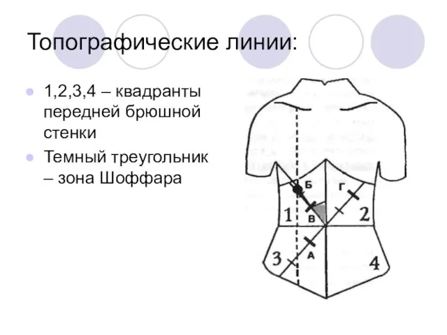 Топографические линии: 1,2,3,4 – квадранты передней брюшной стенки Темный треугольник – зона Шоффара