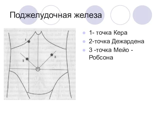 Поджелудочная железа 1- точка Кера 2-точка Дежардена 3 -точка Мейо -Робсона