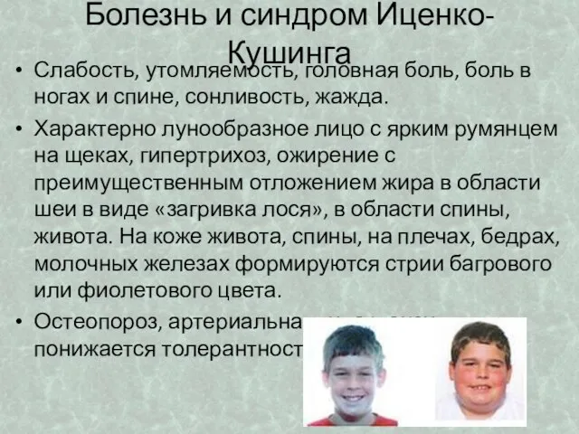 Болезнь и синдром Иценко-Кушинга Слабость, утомляемость, головная боль, боль в ногах