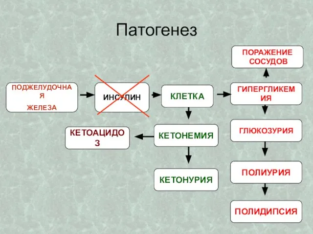 ПОДЖЕЛУДОЧНАЯ ЖЕЛЕЗА ИНСУЛИН КЕТОАЦИДОЗ КЛЕТКА КЕТОНЕМИЯ КЕТОНУРИЯ ГИПЕРГЛИКЕМИЯ ГЛЮКОЗУРИЯ ПОЛИУРИЯ ПОЛИДИПСИЯ Патогенез ПОРАЖЕНИЕ СОСУДОВ