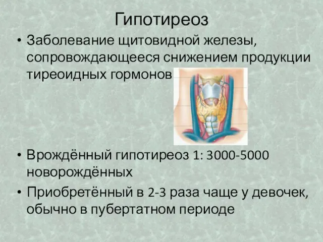 Гипотиреоз Заболевание щитовидной железы, сопровождающееся снижением продукции тиреоидных гормонов Врождённый гипотиреоз