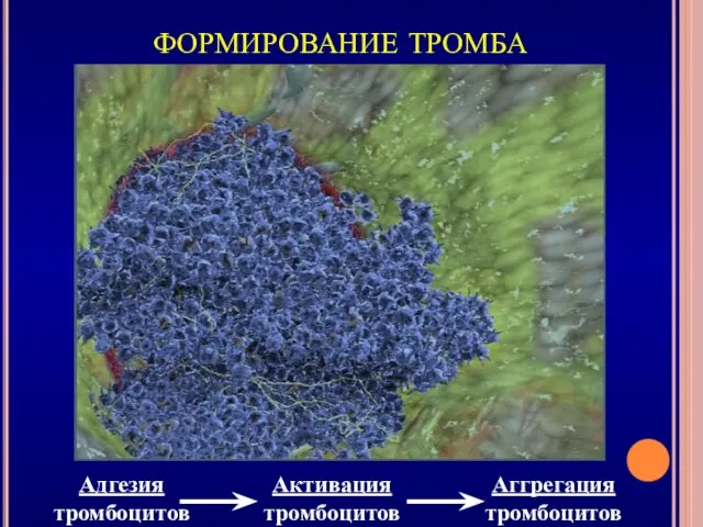 ФОРМИРОВАНИЕ ТРОМБА Адгезия тромбоцитов Активация тромбоцитов Аггрегация тромбоцитов