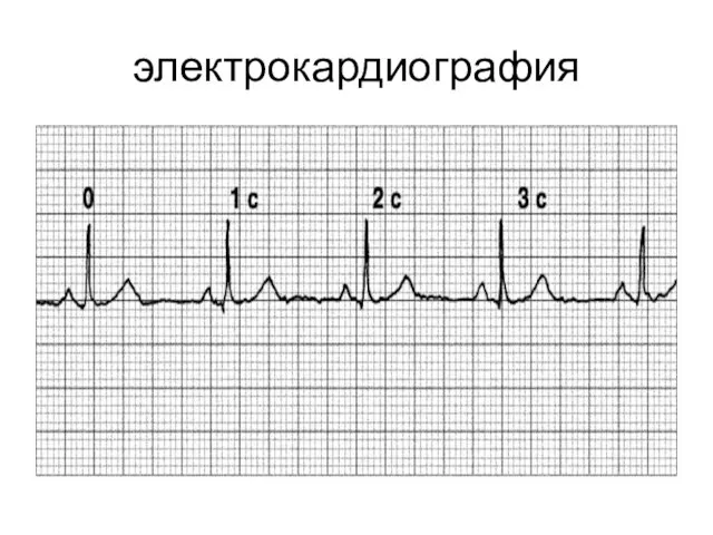 электрокардиография