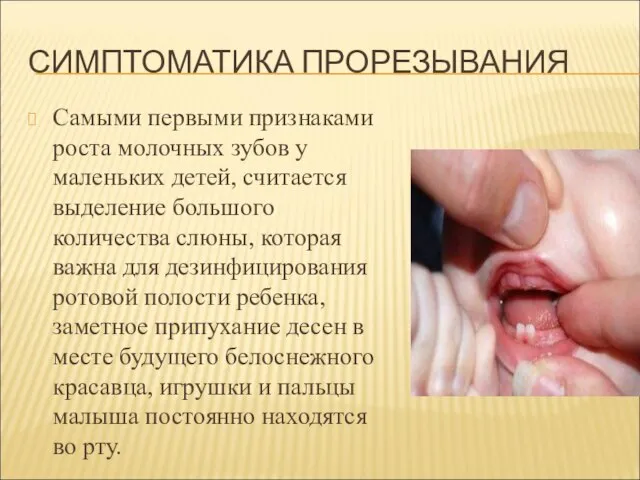 СИМПТОМАТИКА ПРОРЕЗЫВАНИЯ Самыми первыми признаками роста молочных зубов у маленьких детей,