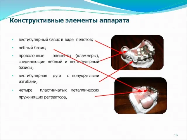 Конструктивные элементы аппарата вестибулярный базис в виде пелотов; нёбный базис; проволочные