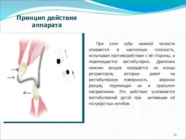 При этом зубы нижней челюсти упираются в наклонную плоскость, испытывая противодействие