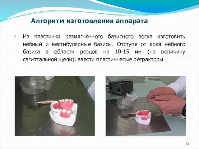 Из пластинки размягчённого базисного воска изготовить нёбный и вестибулярные базисы. Отступя