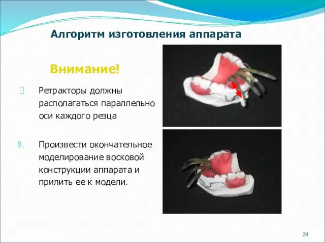 Внимание! Ретракторы должны располагаться параллельно оси каждого резца Произвести окончательное моделирование