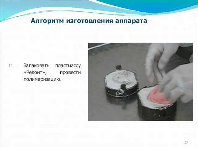 Запаковать пластмассу «Редонт», провести полимеризацию. Алгоритм изготовления аппарата