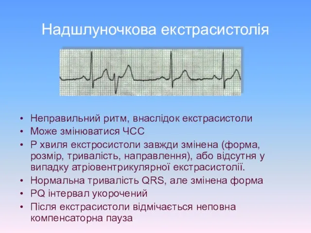 Надшлуночкова екстрасистолія Неправильний ритм, внаслідок екстрасистоли Може змінюватися ЧСС P хвиля