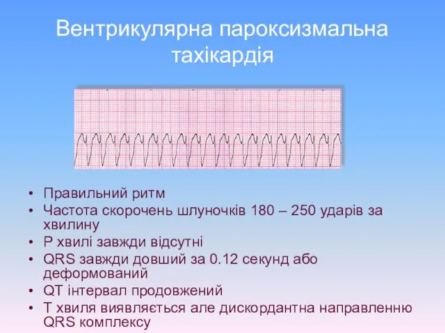 Вентрикулярна пароксизмальна тахікардія Правильний ритм Частота скорочень шлуночків 180 – 250