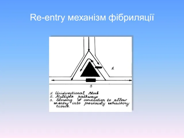 Re-entry механізм фібриляції