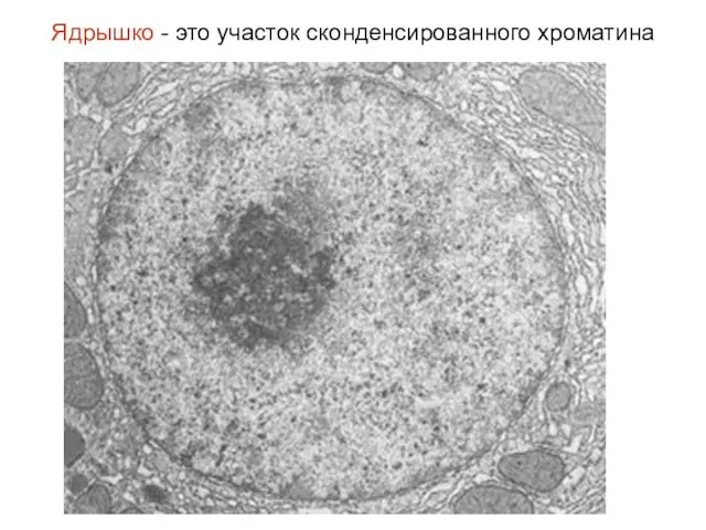 Ядрышко - это участок сконденсированного хроматина