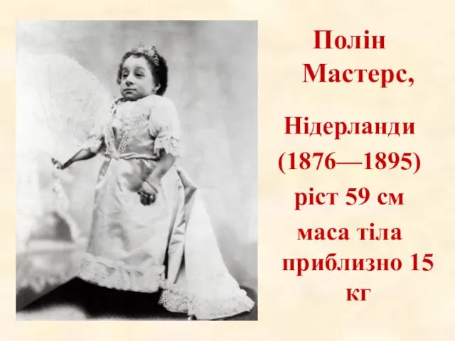 Полін Мастерс, Нідерланди (1876—1895) ріст 59 см маса тіла приблизно 15 кг