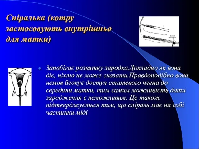 Спіралька (котру застосовують внутрішньо для матки) Запобігає розвитку зародка.Докладно як вона