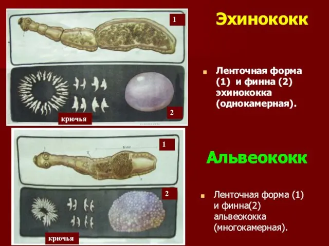 Ленточная форма (1) и финна(2) альвеококка (многокамерная). Ленточная форма (1) и