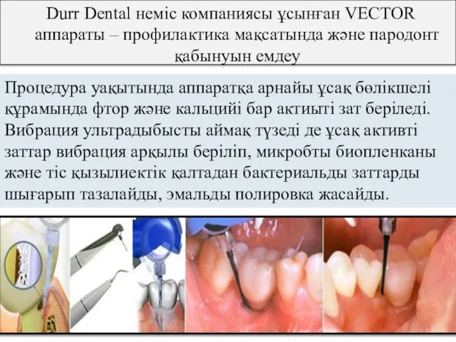 Durr Dental неміс компаниясы ұсынған VECTOR аппараты – профилактика мақсатында және