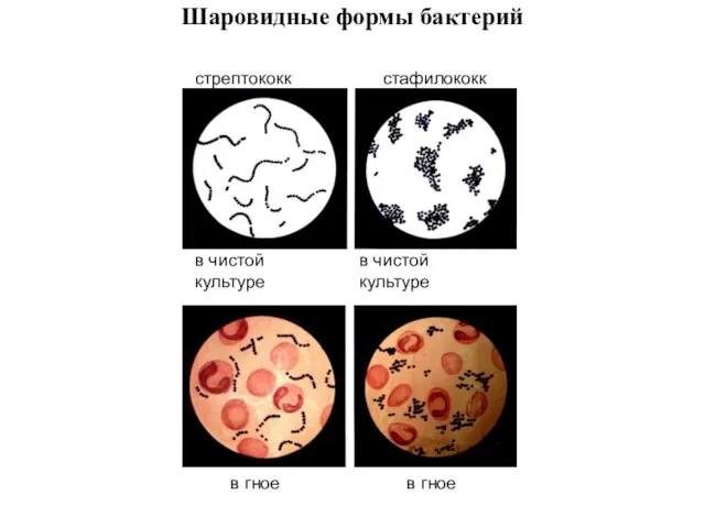 Шаровидные формы бактерий стрептококк стафилококк в чистой культуре в чистой культуре в гное в гное