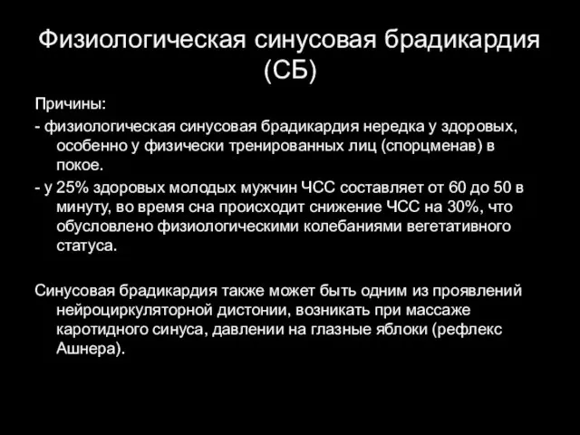 Физиологическая синусовая брадикардия (СБ) Причины: - физиологическая синусовая брадикардия нередка у