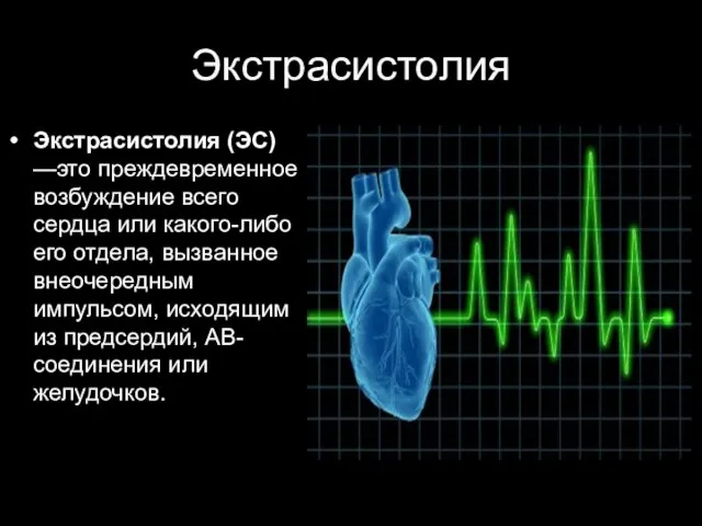 Экстрасистолия Экстрасистолия (ЭС) —это преждевременное возбуждение всего сердца или какого-либо его