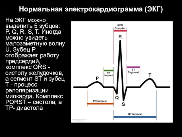 Нормальная электрокардиограмма (ЭКГ) На ЭКГ можно выделить 5 зубцов: P, Q,