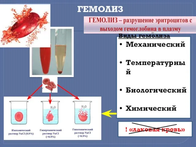 ГЕМОЛИЗ Виды гемолиза Механический Температурный Биологический Химический Осмотический ! «лаковая кровь»