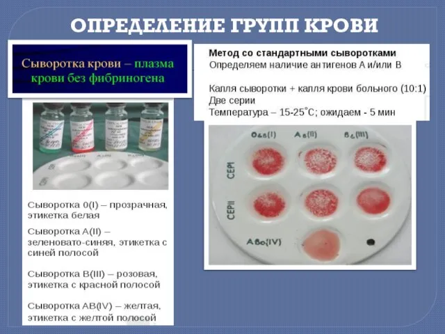 ОПРЕДЕЛЕНИЕ ГРУПП КРОВИ