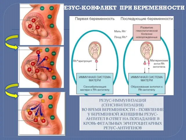 РЕЗУС-КОНФЛИКТ ПРИ БЕРЕМЕННОСТИ