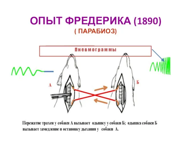 ОПЫТ ФРЕДЕРИКА (1890) ( ПАРАБИОЗ) П н е в м о