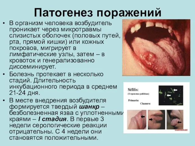 Патогенез поражений В организм человека возбудитель проникает через микротравмы слизистых оболочек