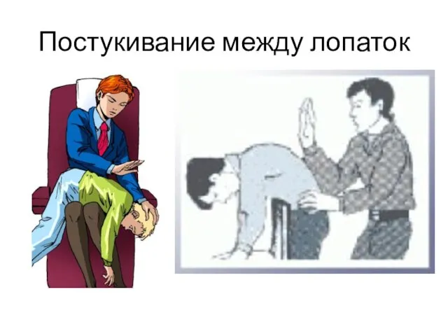 Постукивание между лопаток