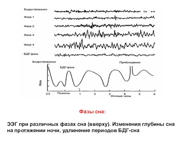 Фазы сна: ЭЭГ при различных фазах сна (вверху). Изменения глубины сна