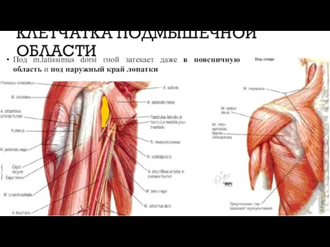 КЛЕТЧАТКА ПОДМЫШЕЧНОЙ ОБЛАСТИ Под m.latissimus dorsi гной затекает даже в поясничную