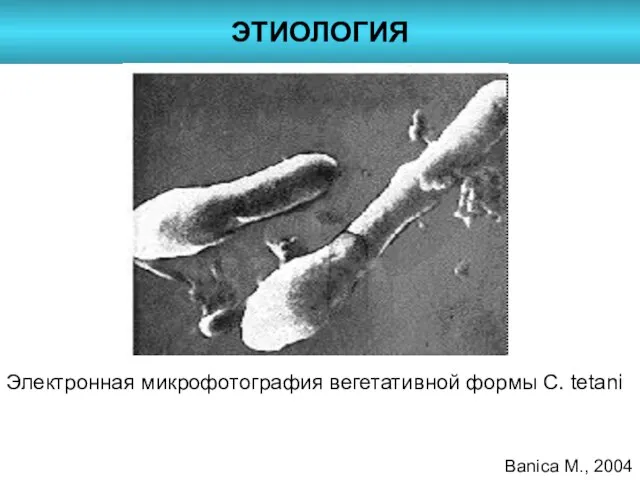 ЭТИОЛОГИЯ Электронная микрофотография вегетативной формы C. tetani Banica M., 2004