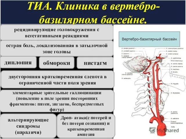 ТИА. Клиника в вертебро- базилярном бассейне. рецидивирующие головокружения с вегетативными реакциями