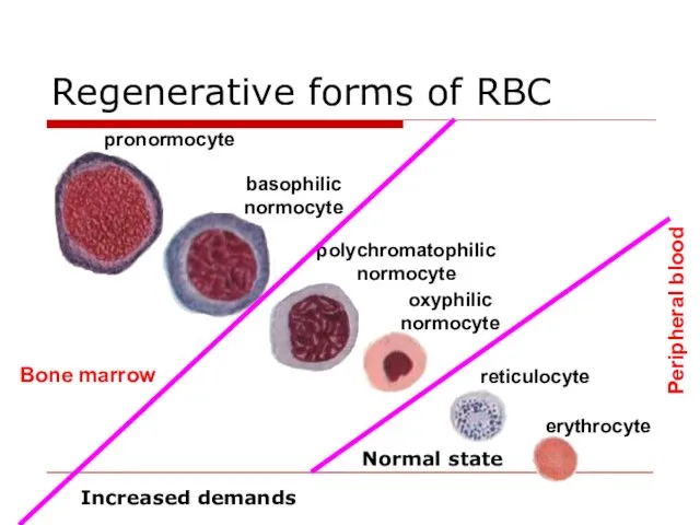 Regenerative forms of RBC Bone marrow Peripheral blood Normal state Increased demands