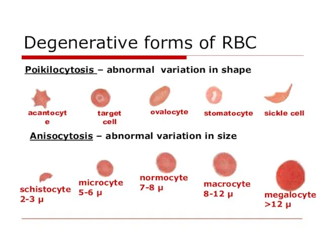 Degenerative forms of RBC Poikilocytosis – abnormal variation in shape target