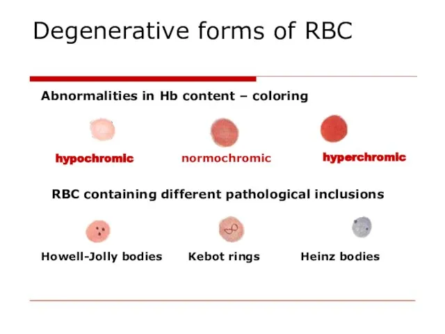 Degenerative forms of RBC Abnormalities in Hb content – coloring hypochromic