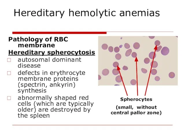 Hereditary hemolytic anemias Pathology of RBC membrane Hereditary spherocytosis autosomal dominant