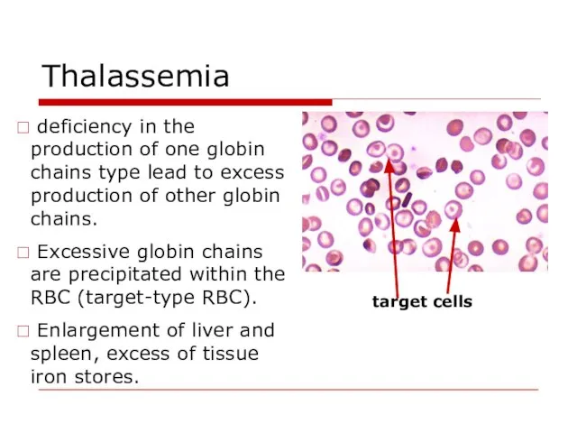 Thalassemia deficiency in the production of one globin chains type lead