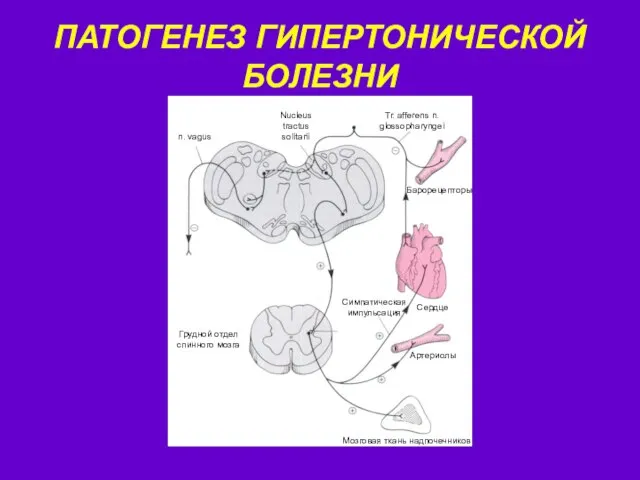 ПАТОГЕНЕЗ ГИПЕРТОНИЧЕСКОЙ БОЛЕЗНИ Барорецепторы Сердце Артериолы Мозговая ткань надпочечников Симпатическая импульсация