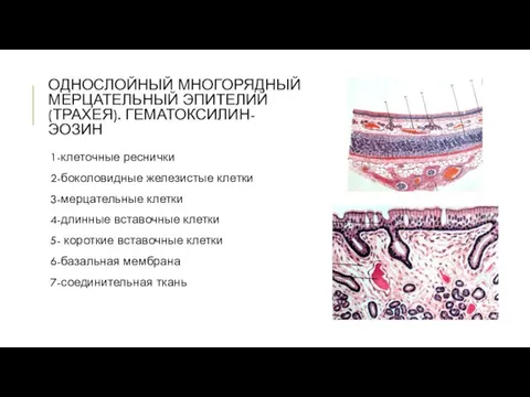 ОДНОСЛОЙНЫЙ МНОГОРЯДНЫЙ МЕРЦАТЕЛЬНЫЙ ЭПИТЕЛИЙ (ТРАХЕЯ). ГЕМАТОКСИЛИН-ЭОЗИН 1-клеточные реснички 2-боколовидные железистые клетки