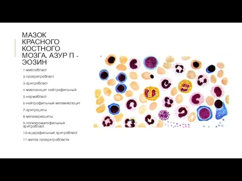 МАЗОК КРАСНОГО КОСТНОГО МОЗГА. АЗУР П - ЭОЗИН 1-миелобласт 2-проэритробласт 3-эритробласт