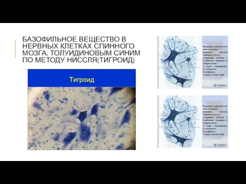 БАЗОФИЛЬНОЕ ВЕЩЕСТВО В НЕРВНЫХ КЛЕТКАХ СПИННОГО МОЗГА. ТОЛУИДИНОВЫМ СИНИМ ПО МЕТОДУ НИССЛЯ(ТИГРОИД)