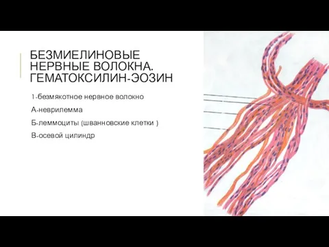 БЕЗМИЕЛИНОВЫЕ НЕРВНЫЕ ВОЛОКНА. ГЕМАТОКСИЛИН-ЭОЗИН 1-безмякотное нервное волокно А-неврилемма Б-леммоциты (шванновские клетки ) В-осевой цилиндр